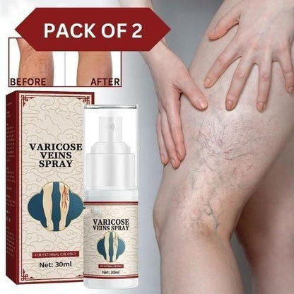 🩵 Vein Healing Varicose Veins Treatment Spray (Pack of 2)